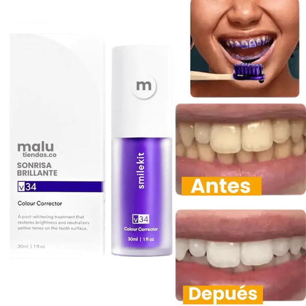 🔥¡SOLO HOY 70% OFF!🔥 - Sonrisa Brillante® - Sérum Correción de Color Dental Instantáneo