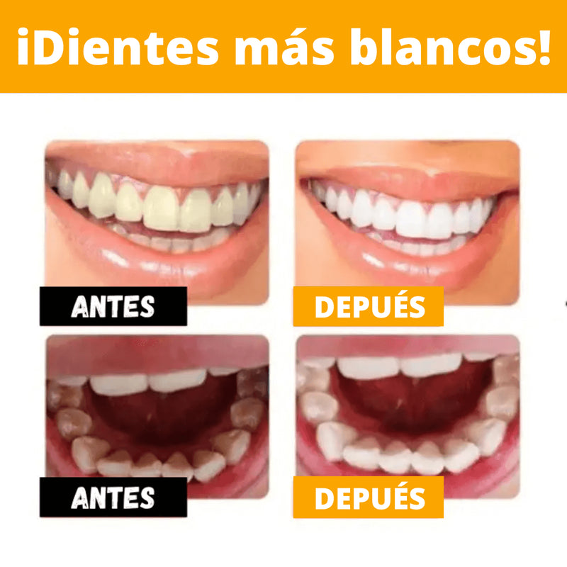 🔥¡SOLO HOY 70% OFF!🔥 - Sonrisa Brillante® - Sérum Correción de Color Dental Instantáneo