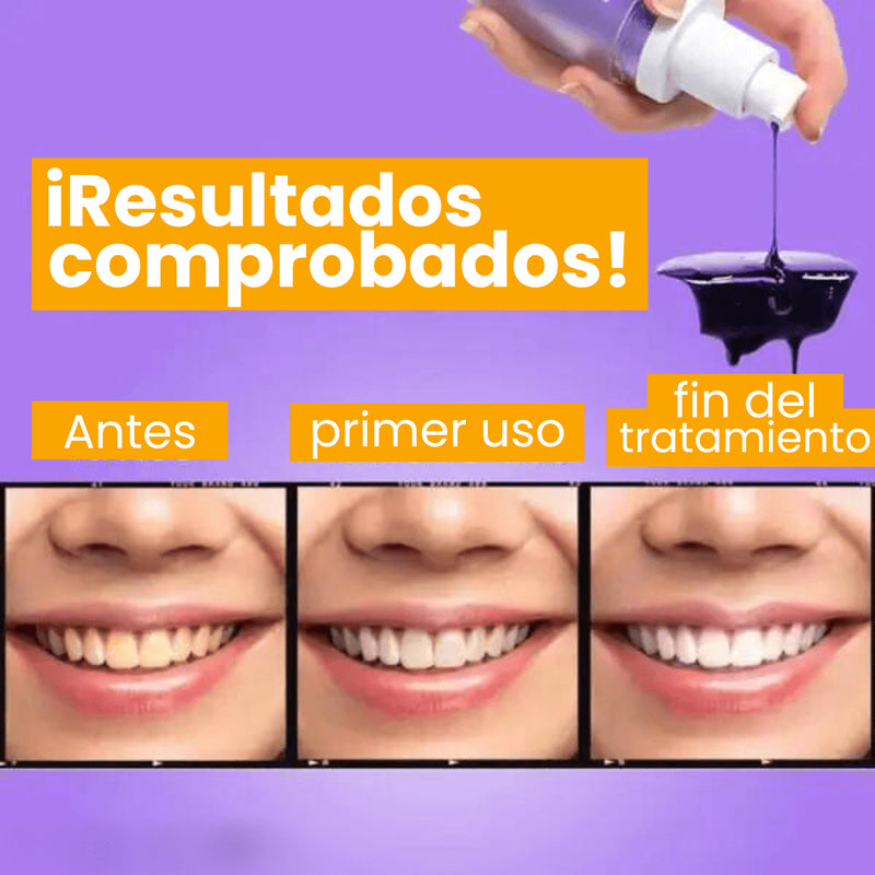 🔥¡SOLO HOY 70% OFF!🔥 - Sonrisa Brillante® - Sérum Correción de Color Dental Instantáneo